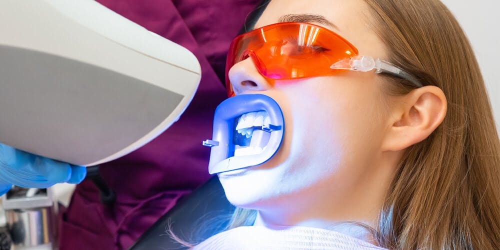 Teeth Whitening